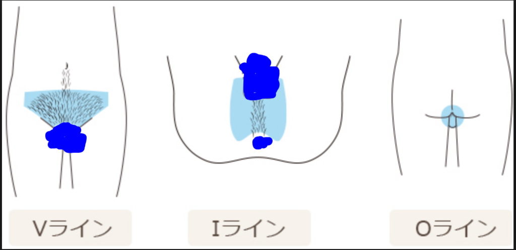 f:id:masahiro_5959:20180416134321p:plain f:id:masahiro_5959:20180416134321p:plain