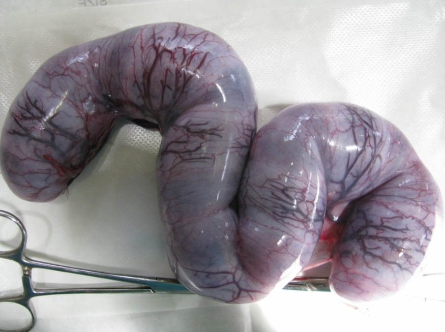 f:id:masami_takasu:20180212191836j:plain f:id:masami_takasu:20180212191836j:plain