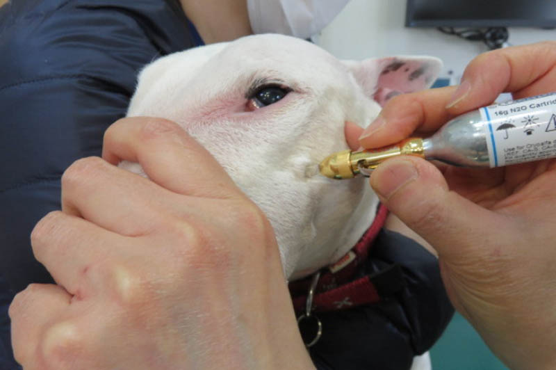 冷凍手術はどのように行われるのか