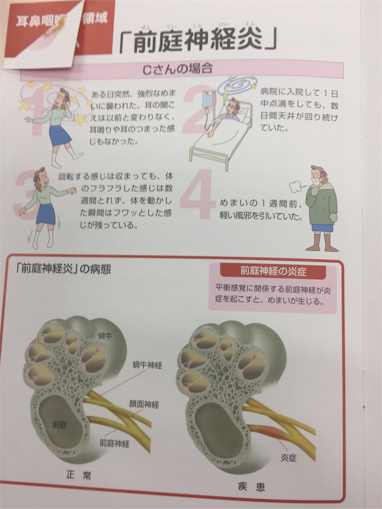 前庭 神経 炎 芸能人