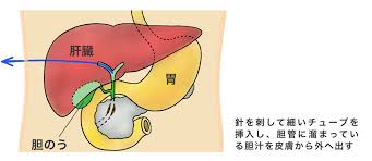 f:id:masatdm1951:20180726115126j:plain