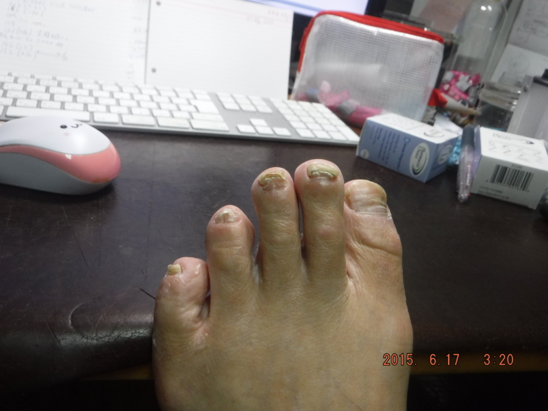 f:id:masaya50:20150617033720j:image:w640