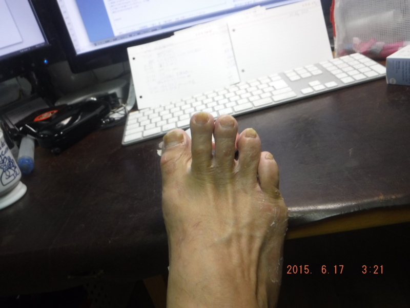 f:id:masaya50:20150617033721j:image:w640