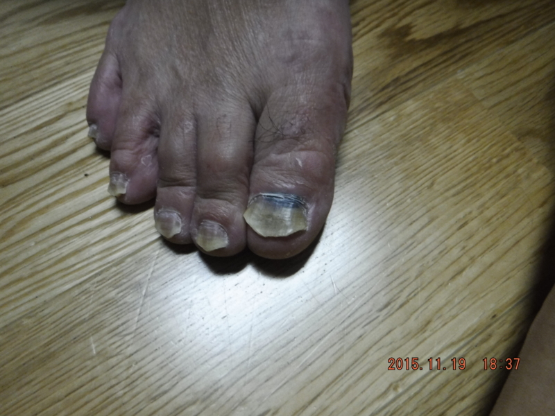 f:id:masaya50:20151119191214:plain f:id:masaya50:20151119191214:plain