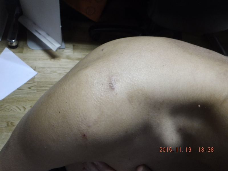 f:id:masaya50:20151119191216j:plain f:id:masaya50:20151119191216j:plain