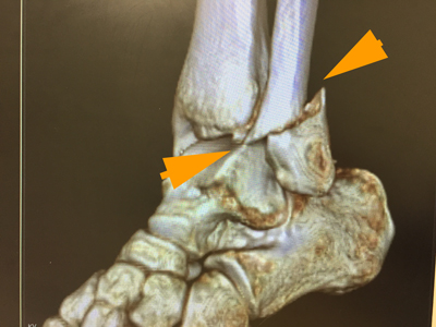 f:id:masayukigt:20170329222701j:plain f:id:masayukigt:20170329222701j:plain