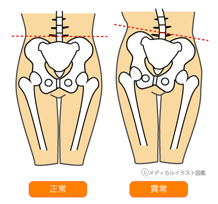 f:id:massadayo:20190209000721p:plain f:id:massadayo:20190209000721p:plain