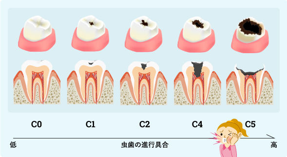 f:id:masterofchemcal:20180314170531j:plain f:id:masterofchemcal:20180314170531j:plain