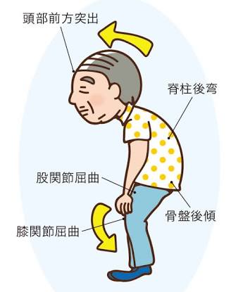 5分で円背姿勢を撃退!?〇〇を使ったお手軽ストレッチとは? - conditioning master