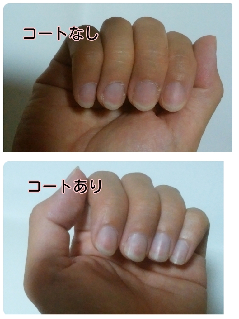 ネイルオフ後の比較