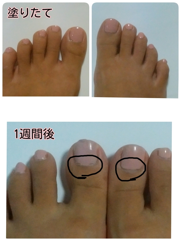 塗りたてと1週間後を比較したペディキュア