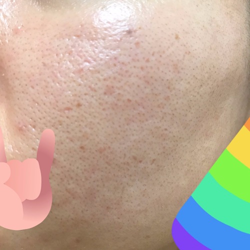 f:id:mcosme:20191216215612j:plain f:id:mcosme:20191216215612j:plain
