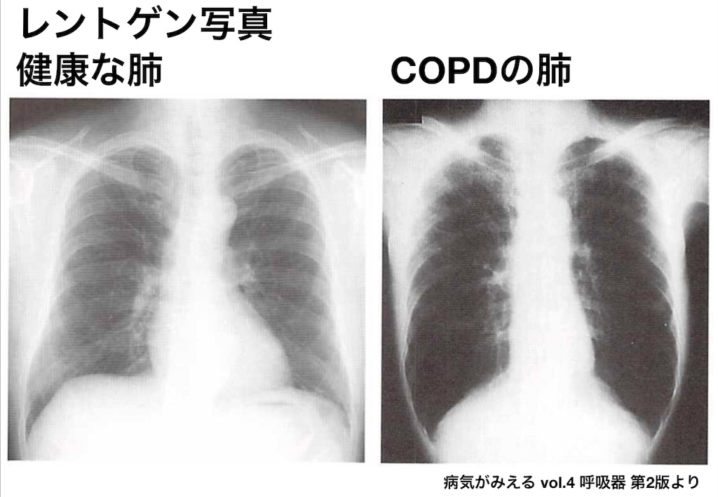 f:id:med-info4parents:20190130160812j:image