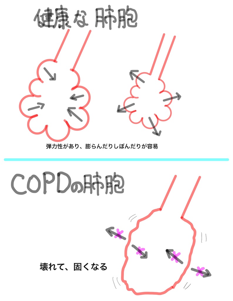 f:id:med-info4parents:20190130160839j:image
