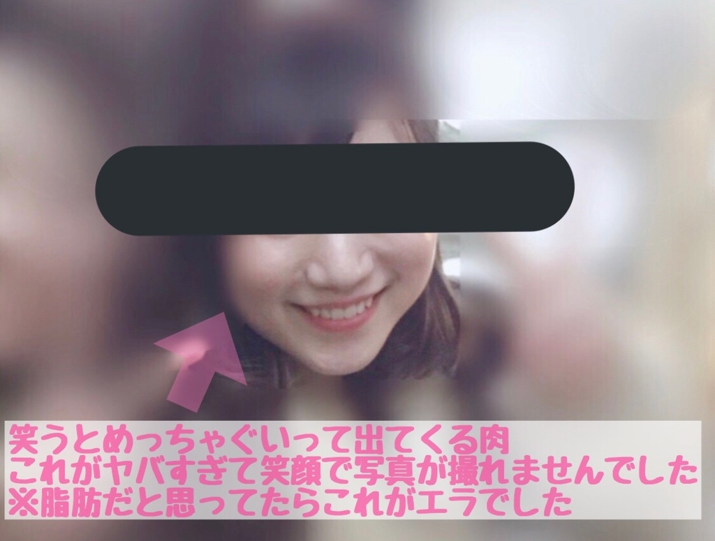f:id:mederublog:20190225011811j:plain f:id:mederublog:20190225011811j:plain