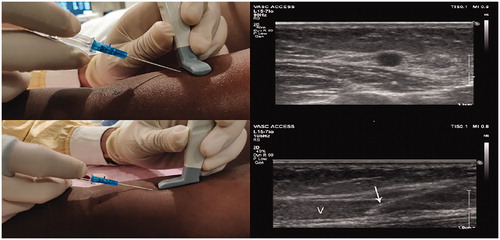 f:id:medical-educator:20201201064105j:plain