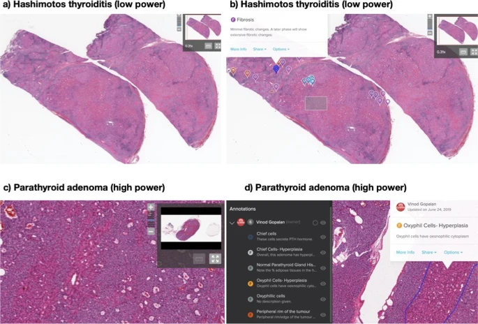 f:id:medical-educator:20220110062422p:plain