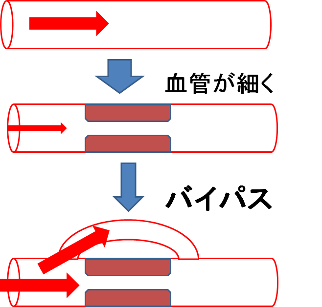 f:id:medudent:20180214165914p:plain f:id:medudent:20180214165914p:plain