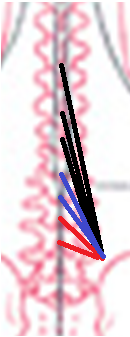 f:id:medudent:20180226204303p:plain f:id:medudent:20180226204303p:plain
