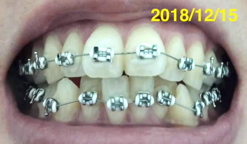 f:id:meeme0033:20190112130233j:plain