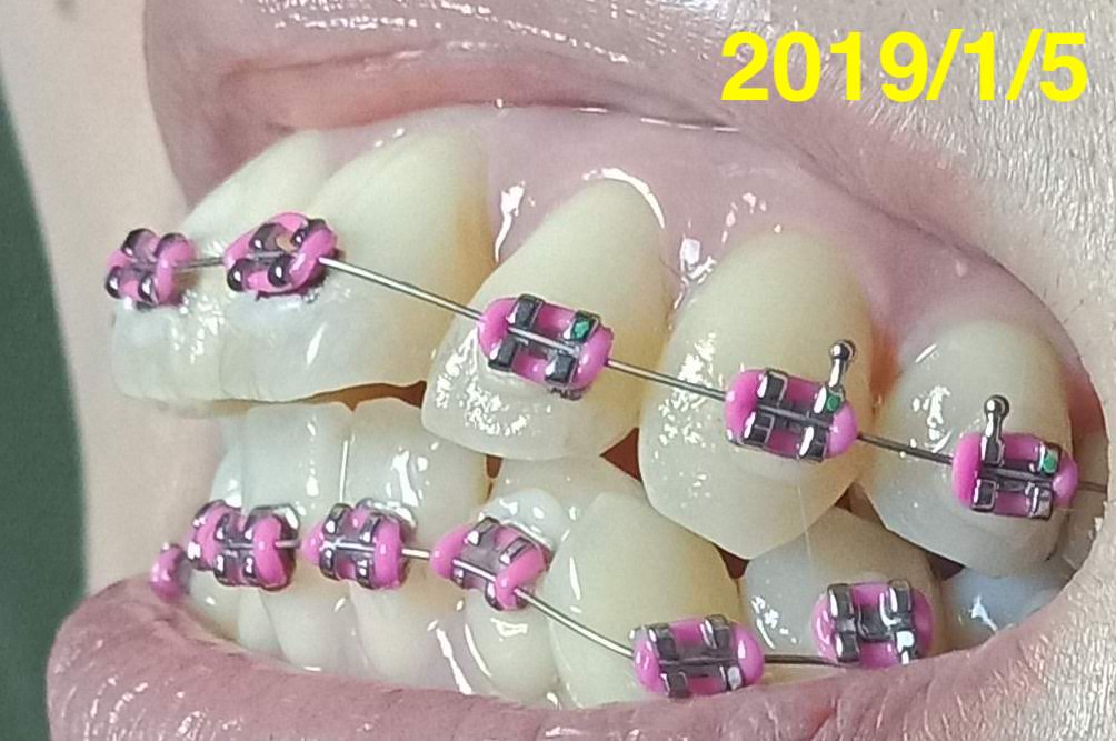 f:id:meeme0033:20190112130345j:plain