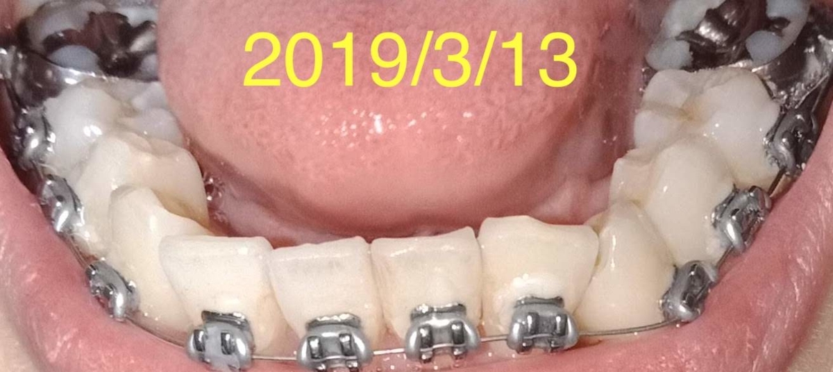 f:id:meeme0033:20190313174359j:plain