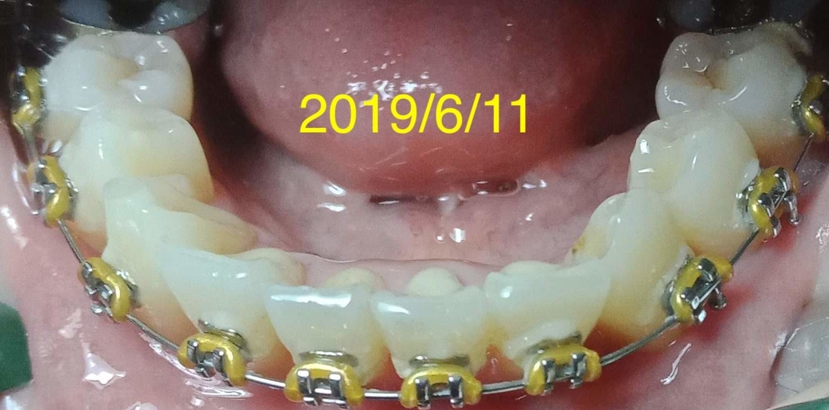 f:id:meeme0033:20190619214825j:plain