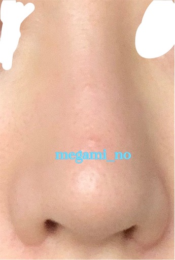 f:id:megami_no:20190125190532j:image f:id:megami_no:20190125190532j:image