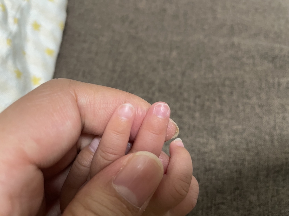 新生児から使えるコンビの人気の爪切り「ネイルケアセット」で爪をカットした赤ちゃん