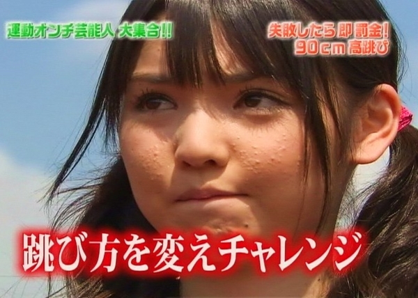 道重さゆみ肌荒れ Dark Blueの絵日記