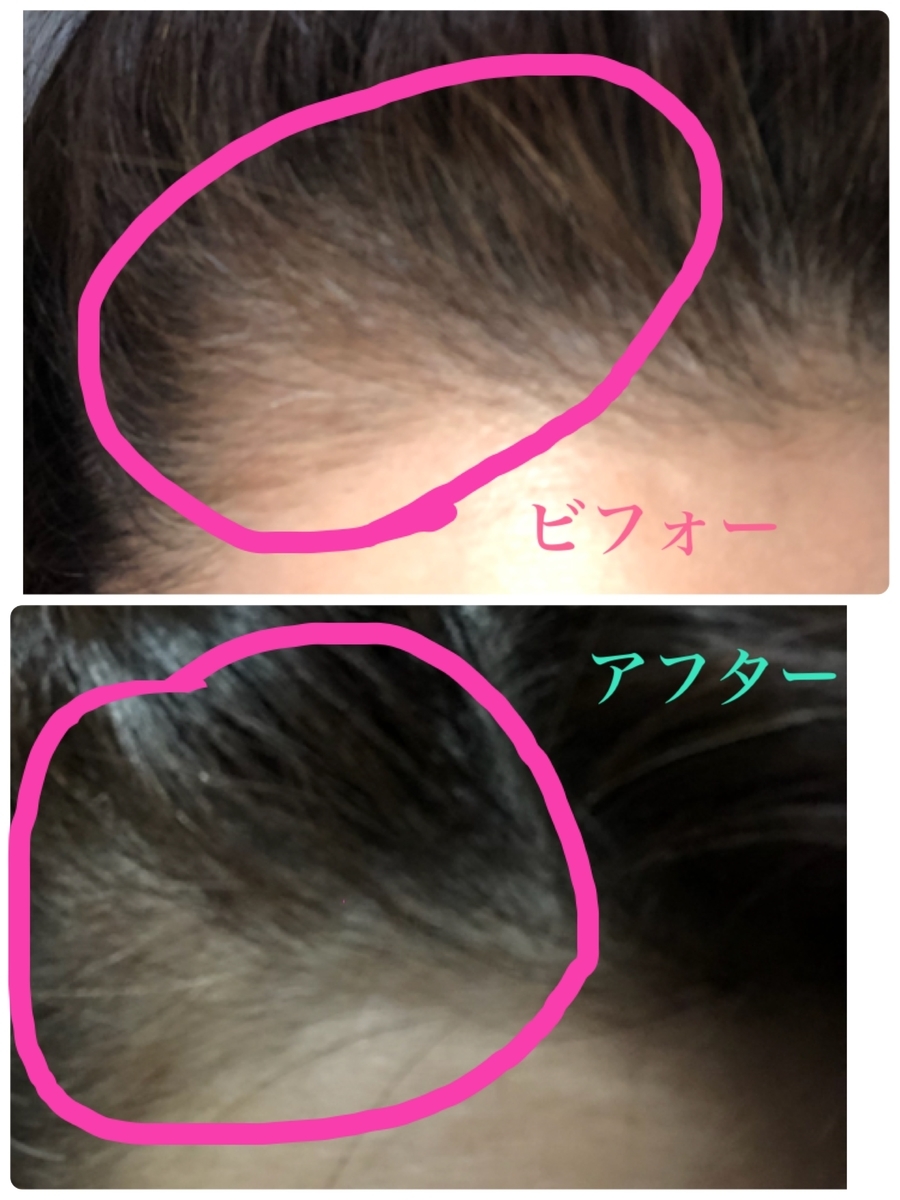f:id:meikosan55:20190425154527j:plain