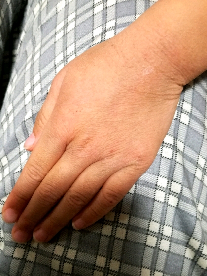 子供の手荒れを解決したい Mecchiのほのぼの生活