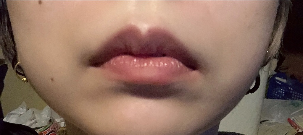 f:id:menhelako:20190625193258j:image