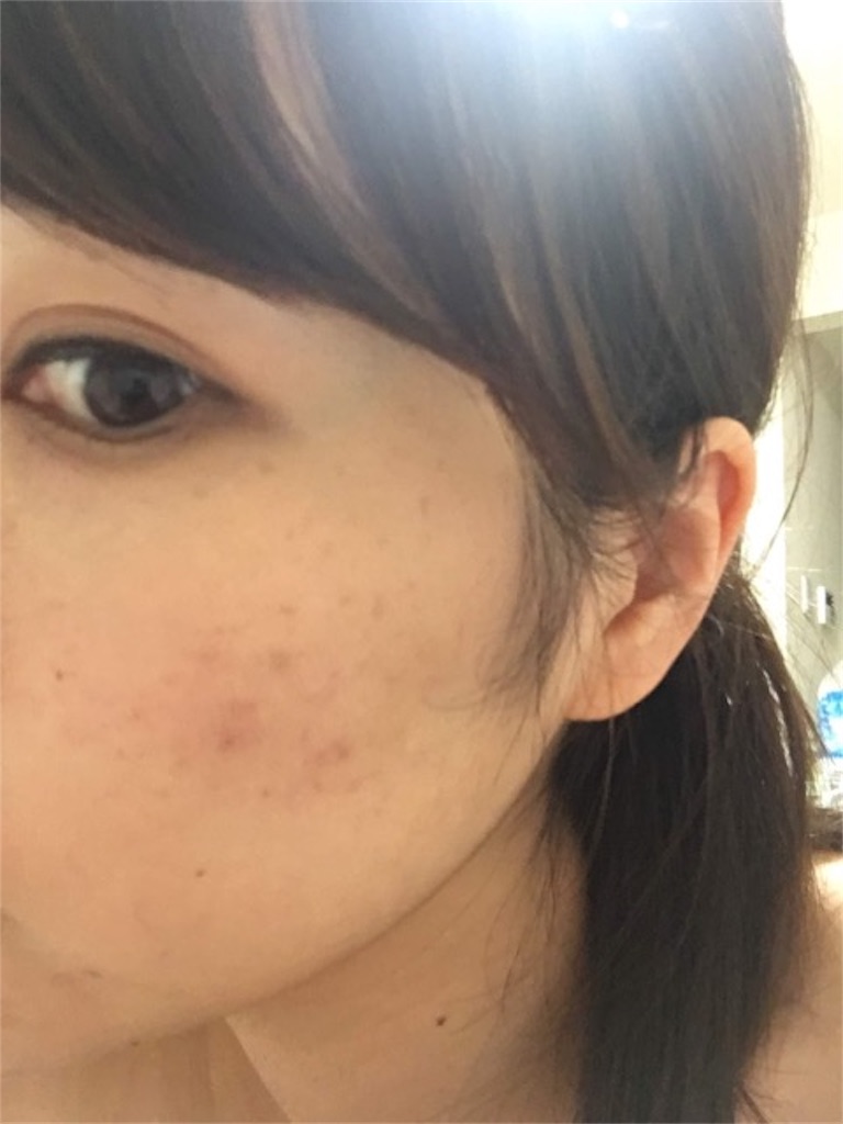 f:id:menoshita_kumao:20190912202937j:image f:id:menoshita_kumao:20190912202937j:image