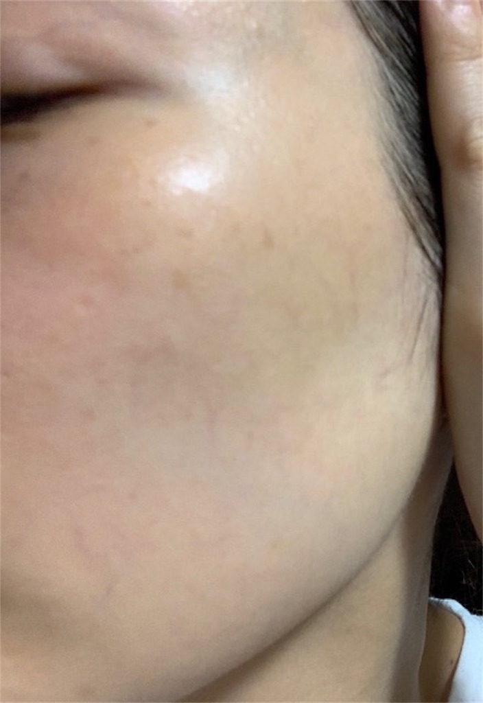 f:id:menoshita_kumao:20190912203100j:image f:id:menoshita_kumao:20190912203100j:image