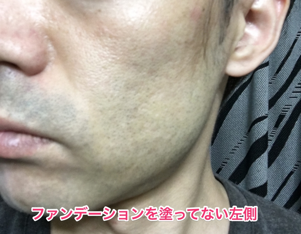 24hコスメのメンズパウダーファンデーションは青ヒゲを隠せるのか メンズライト 02ナチュラルオークル 編 目指せマイナス10歳 アラフォー男のアンチエイジング情報 24hコスメのメンズパウダーファンデーションは青ヒゲを隠せるのか メンズライト 02ナチュラルオークル 編 目指せマイナス10歳 アラフォー男のアンチエイジング情報