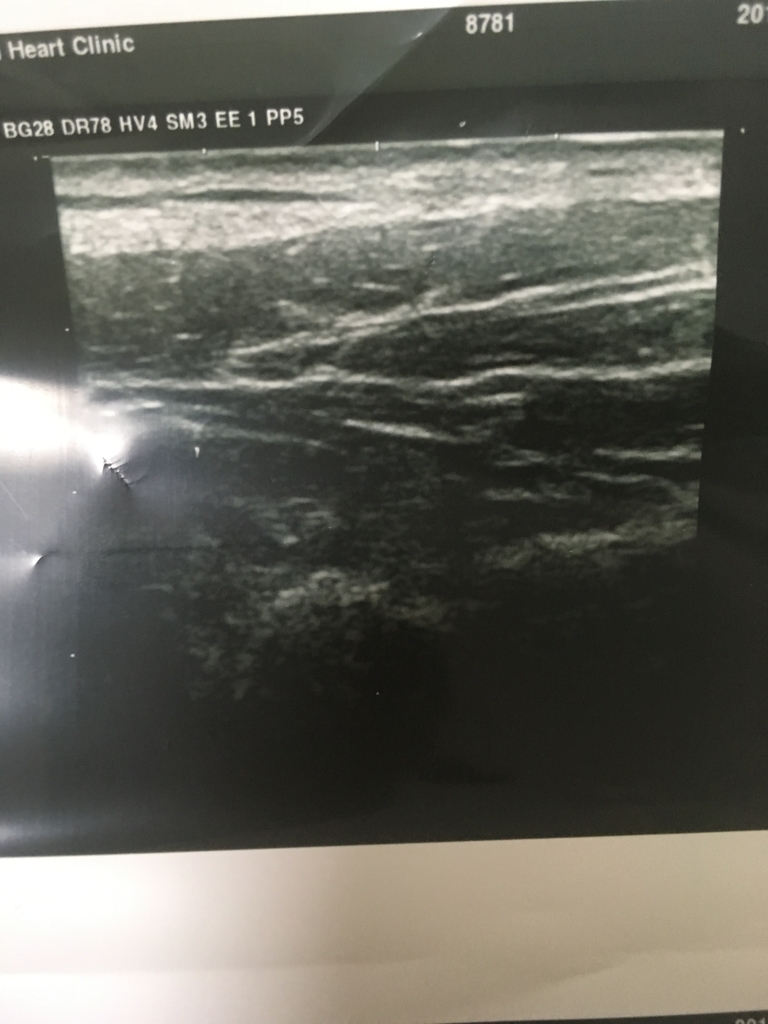 f:id:merry4webmarketing:20190218174446j:plain