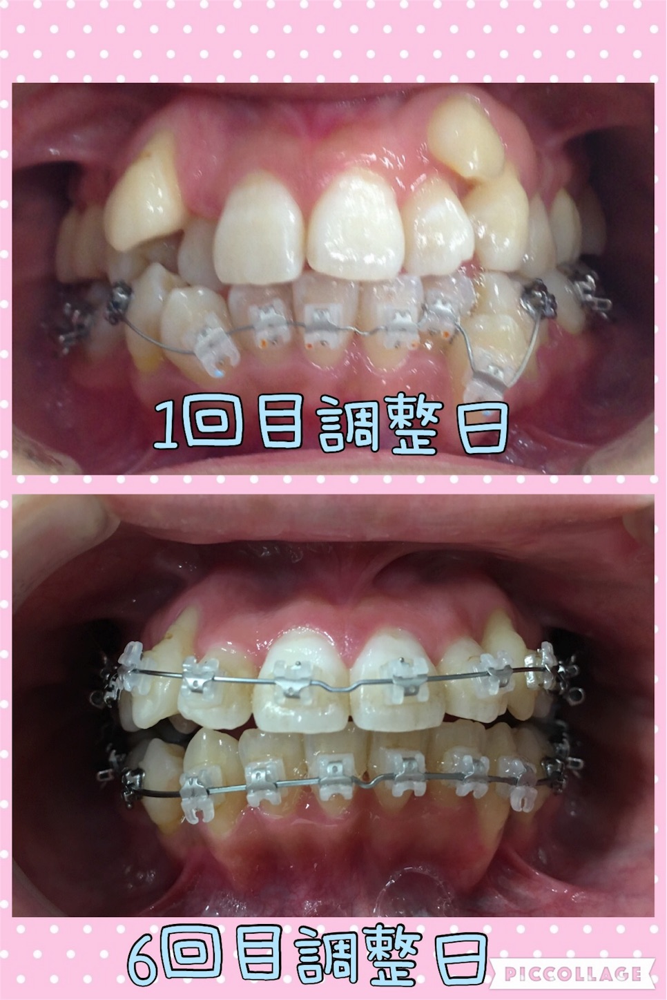 f:id:mgwuamg:20160818211716j:image f:id:mgwuamg:20160818211716j:image