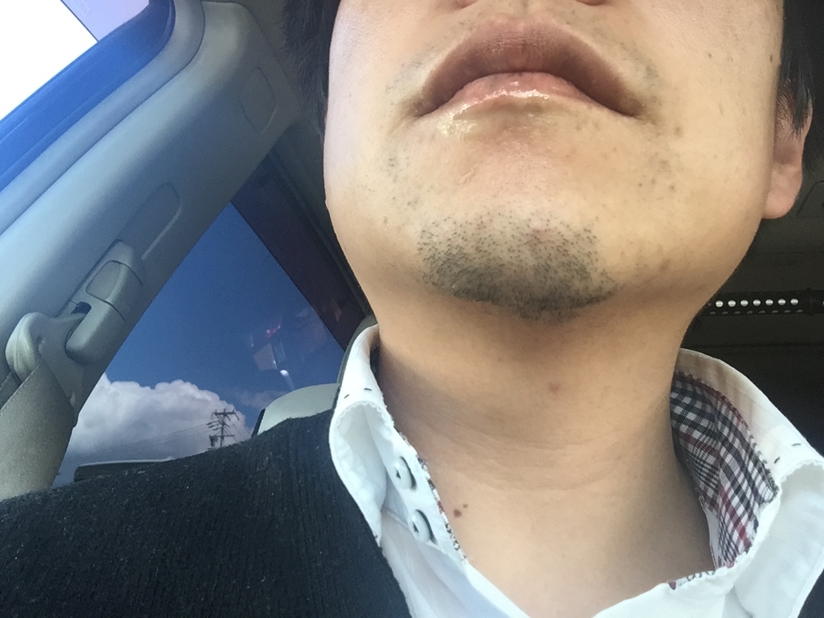 f:id:mi--yan:20200322182151j:plain f:id:mi--yan:20200322182151j:plain