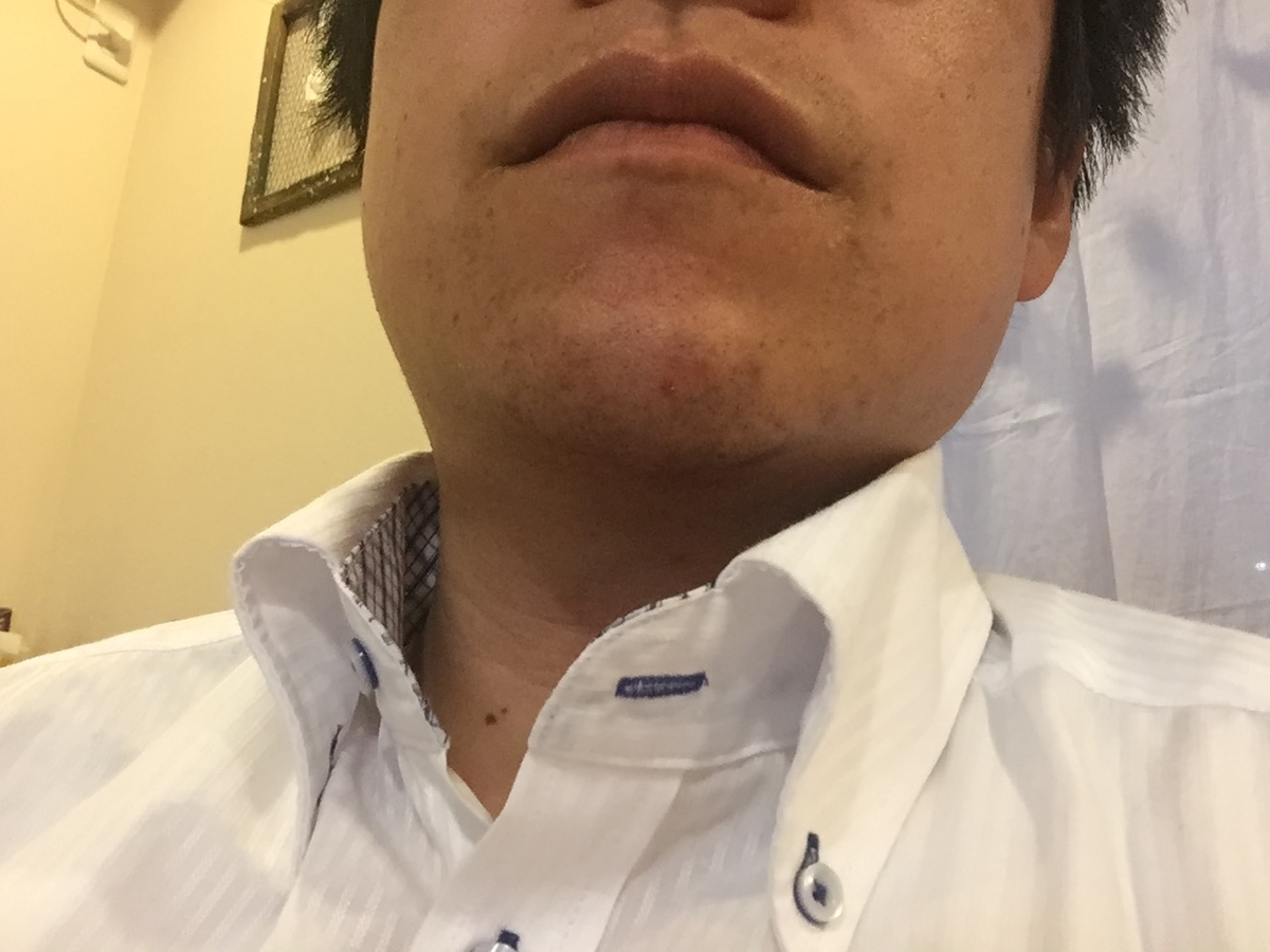 f:id:mi--yan:20200322182207j:plain f:id:mi--yan:20200322182207j:plain