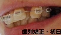 f:id:mi-happy-tanosii:20170518090952j:plain f:id:mi-happy-tanosii:20170518090952j:plain