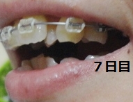 f:id:mi-happy-tanosii:20170518091004j:plain f:id:mi-happy-tanosii:20170518091004j:plain