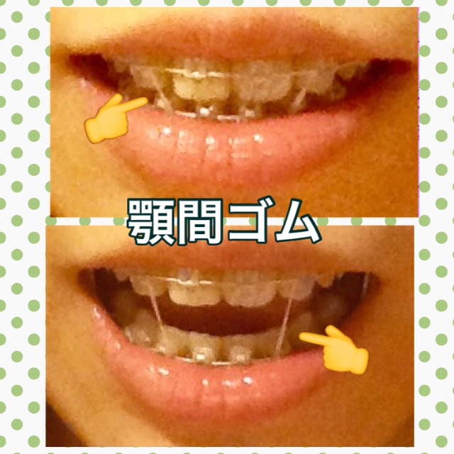 f:id:midori32:20150703001451j:image f:id:midori32:20150703001451j:image