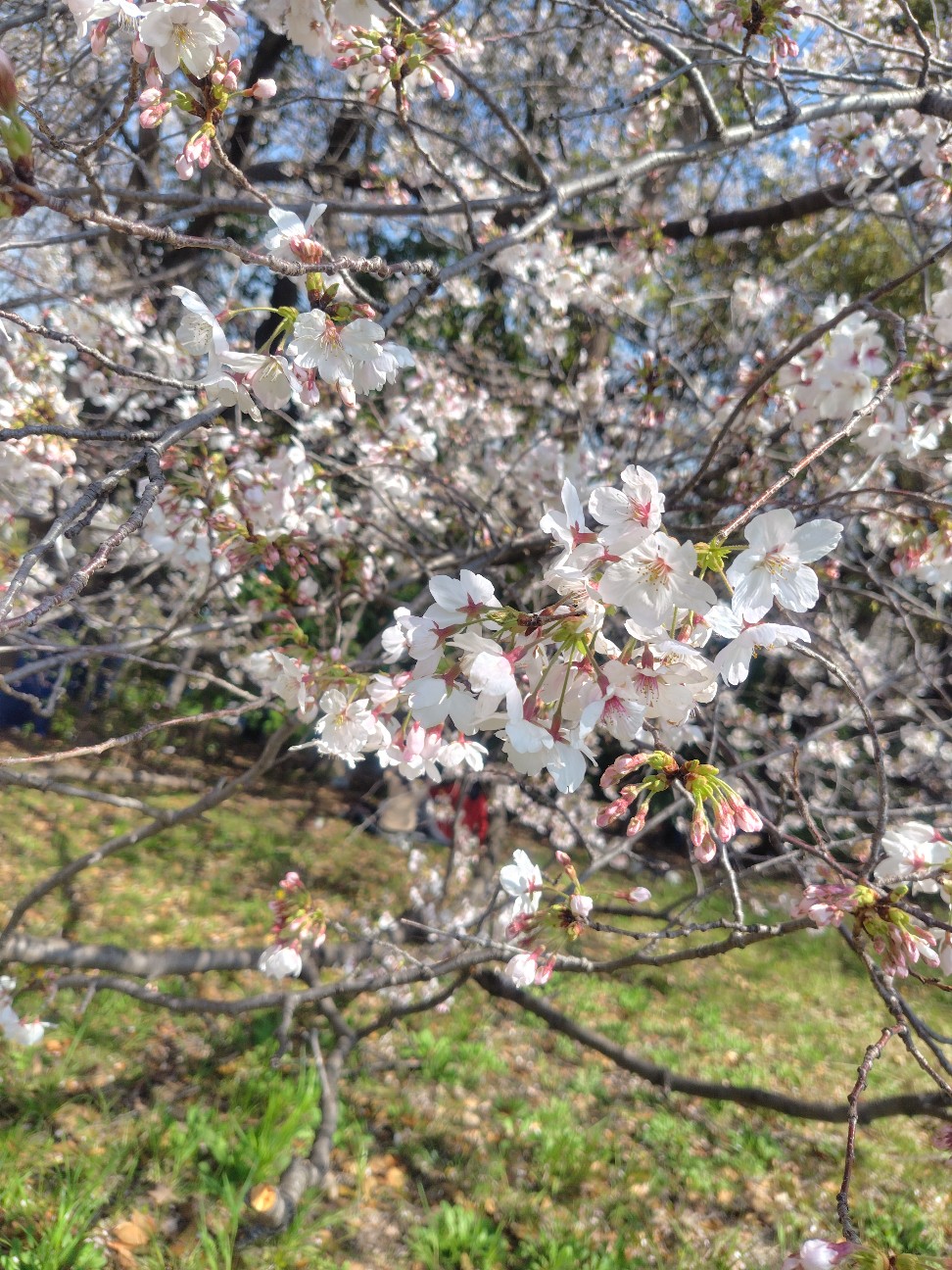f:id:migraine00:20260403134619j:image