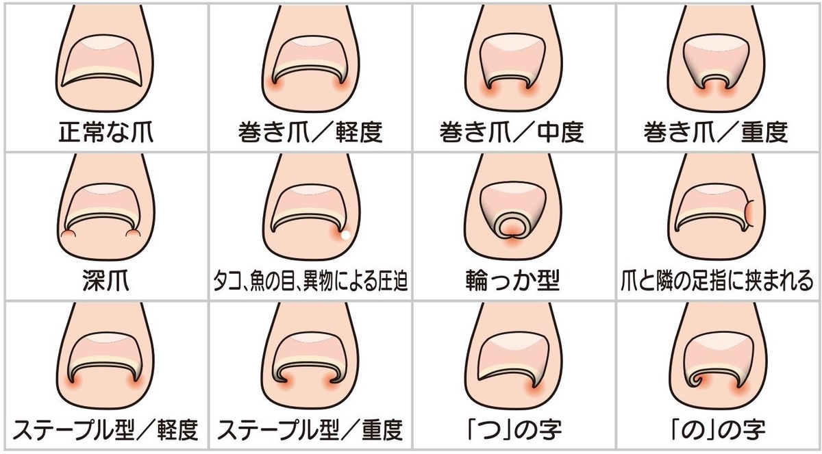 f:id:mihomoriyama:20200422105801j:plain f:id:mihomoriyama:20200422105801j:plain