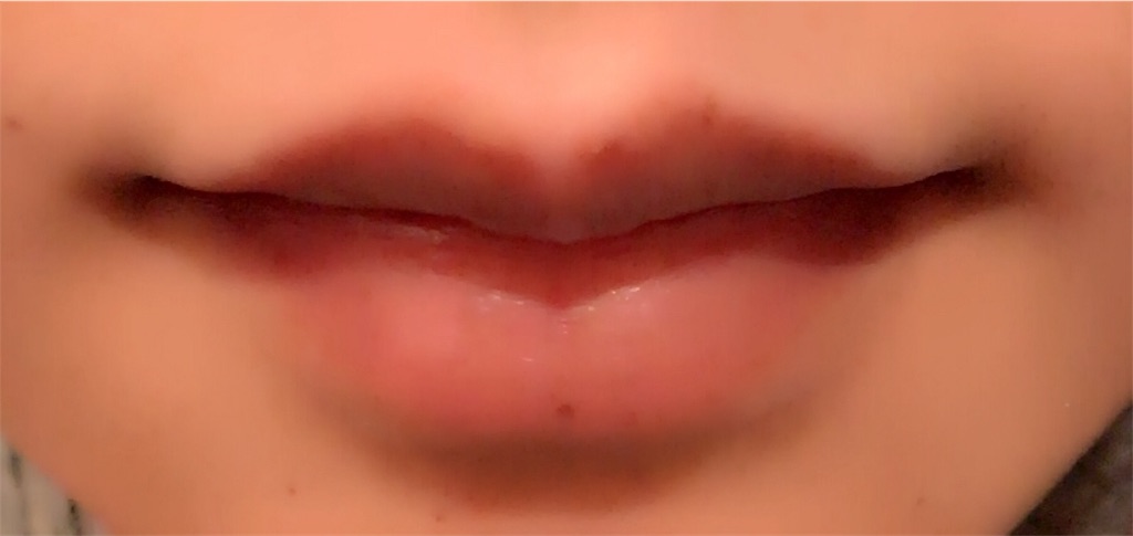 f:id:mii0309eyelist:20180119223853j:image f:id:mii0309eyelist:20180119223853j:image