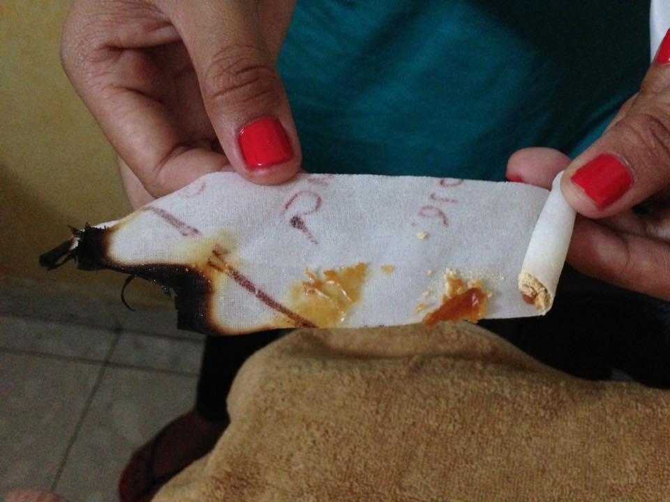 耳にロウソク バリのびっくりエステ イヤーキャンドルって バリ島 インドネシア ３歳と 世界一周ふたり旅 ハワイ南米北欧中東アジア５ヶ月