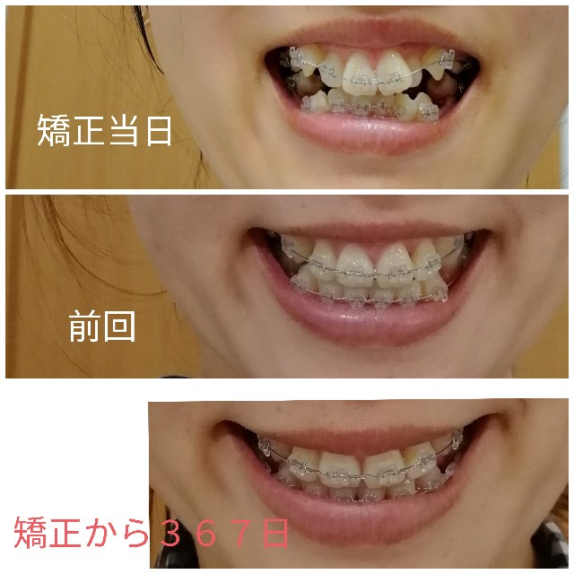 f:id:miichanmama5:20190922160451j:image f:id:miichanmama5:20190922160451j:image