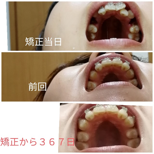 f:id:miichanmama5:20190922160632j:image f:id:miichanmama5:20190922160632j:image