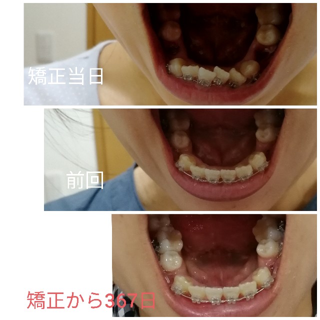 f:id:miichanmama5:20190922160834j:image f:id:miichanmama5:20190922160834j:image